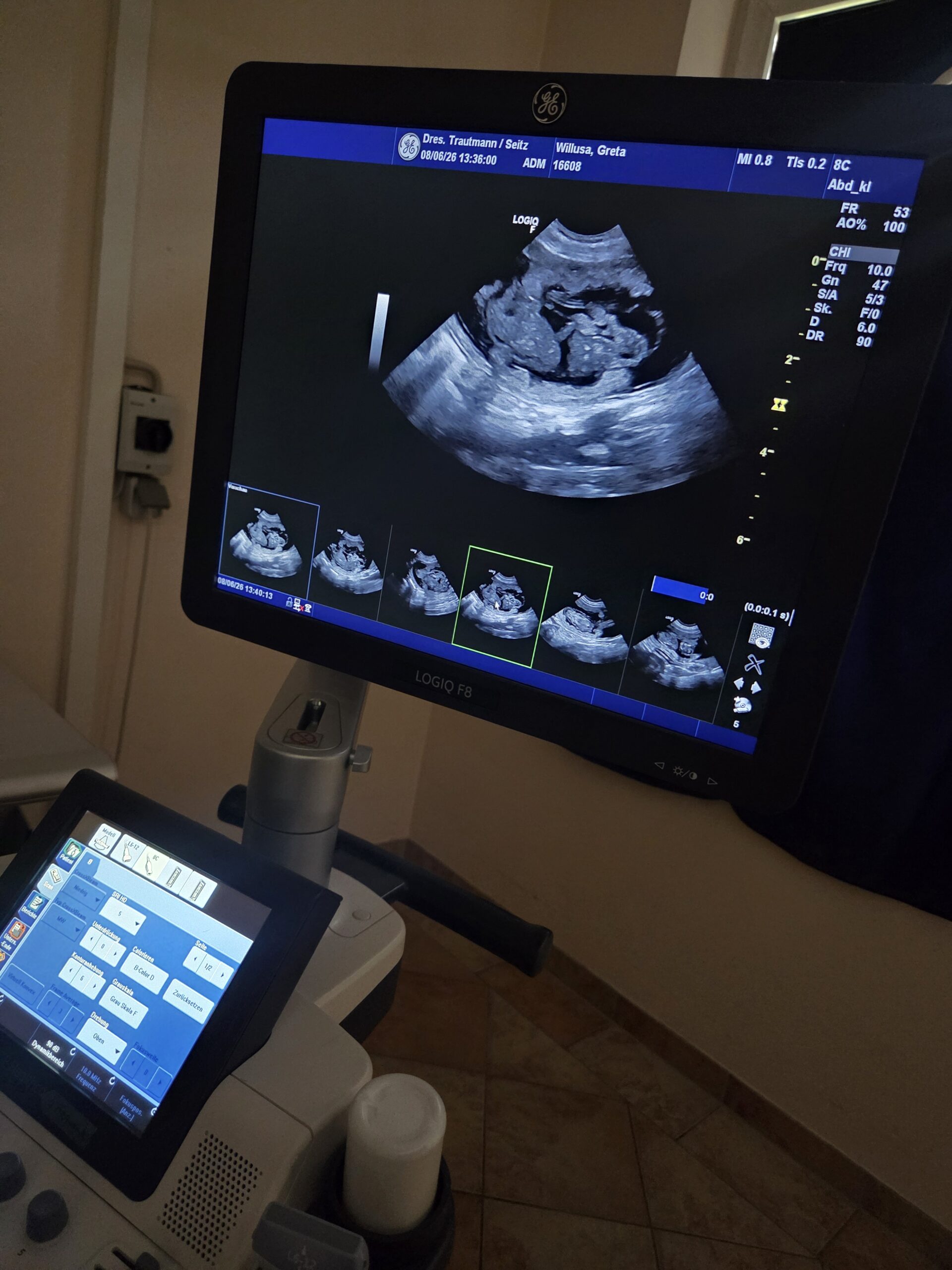 F-Wurf Willusa’s